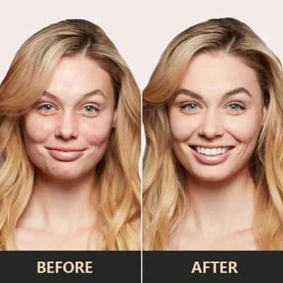 LumiMush™ - CC-Creme (1+1 GRATIS)