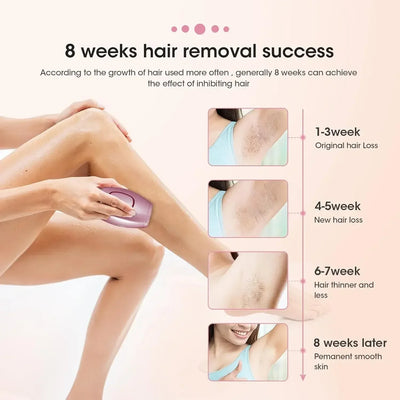 Radiance™ - Schmerzloser IPL-Laser-Haarentferner