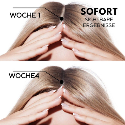 1+1 GRATIS | HairRegrow™ | Haarwachstumsspray